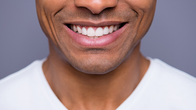 The image features a man with a broad smile, showcasing his teeth and expressing happiness.