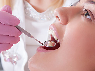 A dental professional performing a teeth cleaning procedure, with the patient s mouth open and a dental tool in use.